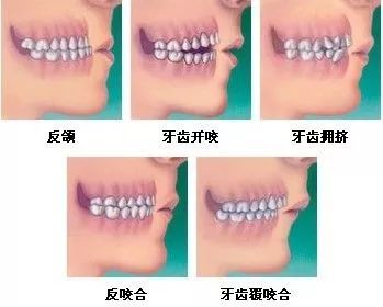 牙齿矫正