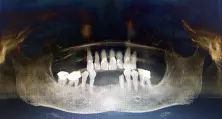 杭州西湖口腔医院