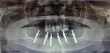 杭州西湖口腔医院